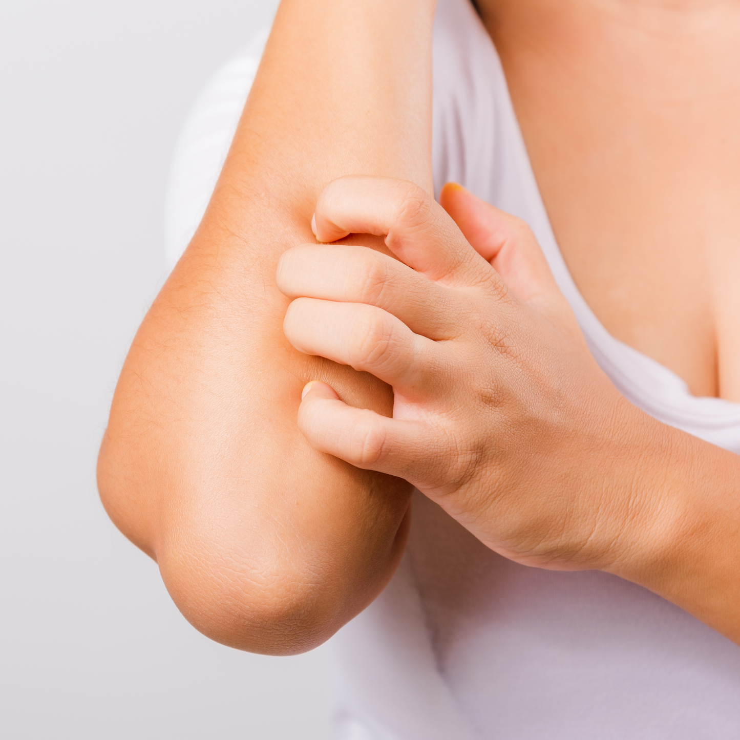 Baume après-piqûre